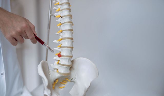Ein Wirbelsäulenchirurgie-Spezialist erklärt die Zementstabilisierung der Wirbelkörper.