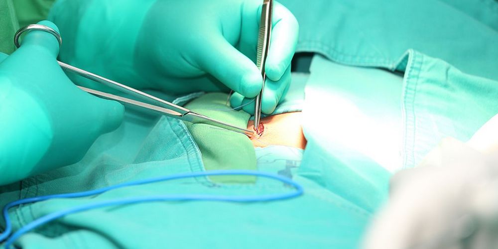 Spezialisten für Hernienchirurgie bei einem offenen Operationsverfahren.
