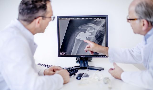 Zwei Onkologen besprechen anhand einer Röntgenaufnahme, ob eine Kryotherapie im Rahmen der lokalen Tumortherapie möglich ist.