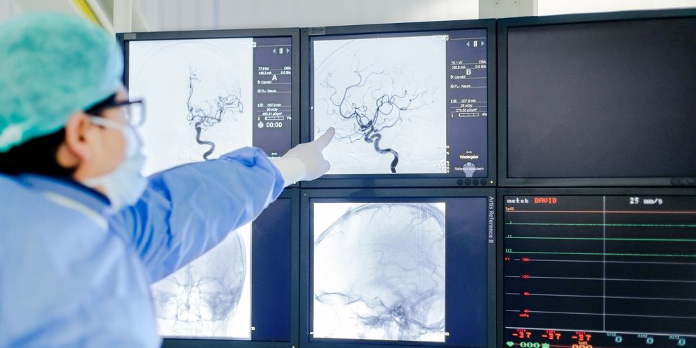 Was ist Gefäßchirurgie? Ein Facharzt für Gefäßchirurgie betrachtet eine Angiografie.