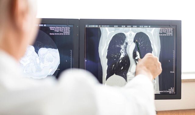Aufnahme aus der Radiologie der Computer. Ein Arzt zeigt mit einem Stift etwas auf dem Bild. 