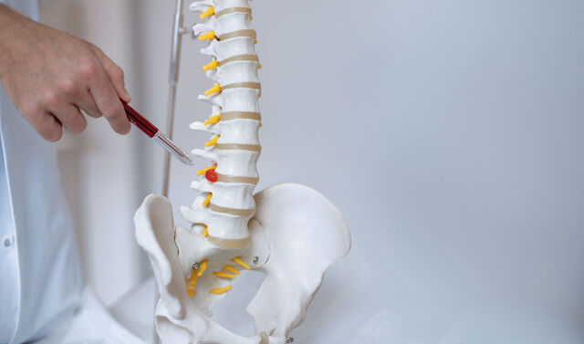 Ein Arzt der Orthopädie erklärt etwas an einem Skelett-Modell der Wirbelsäule.
