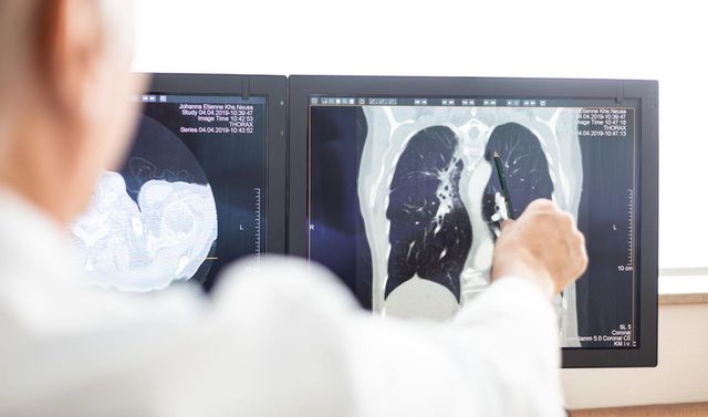 Ein Arzt betrachtet ein Röntgenbild in der radiologischen Abteilung des Notfallzentrums. 