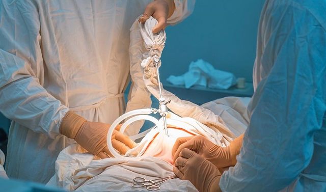 Fachärzte für Chirurgie operieren die Hernie eines Patienten.