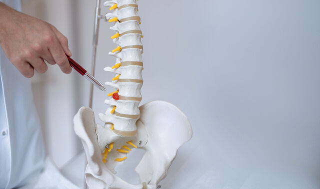 Abgebildet ist ein Arzt der Orthopädie im Johanna Etienne Krankenhaus, der die Wirbelsäule an einem Modell untersucht. 
