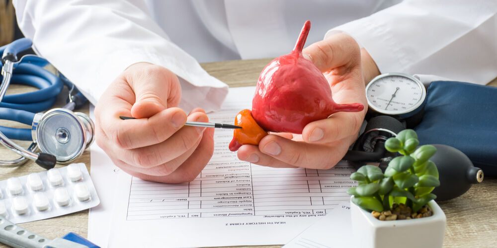 Was bedeutet Tumortherapie? Ein Facharzt erklärt die Tumortherapie an einem Prostata-Modell.