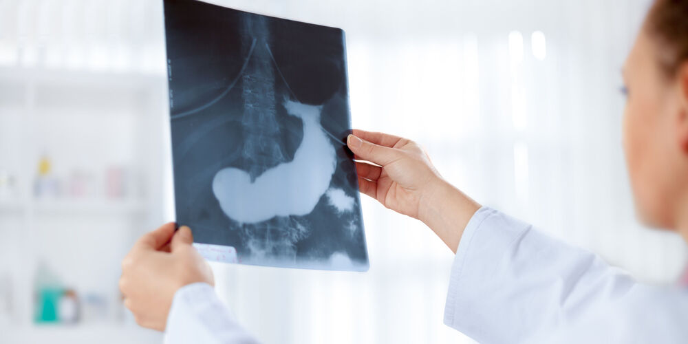 Eine Fachärztin der Onkologie untersucht im Rahmen einer Tumortherapie den CT-Scan einer Bauchspeicheldrüse.