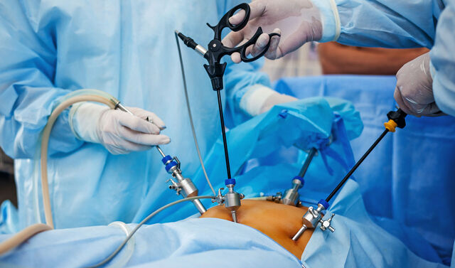 Minimal-invasive Operationsverfahren in der Urogynäkologie. 