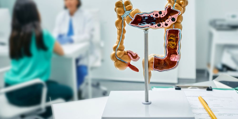 Ein Modell des menschlichen Darms inkl. Blinddarm, im Hintergrund eine Ärztin und eine Patientin im Gespräch.