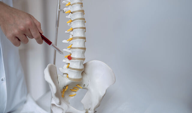 Ein Arzt aus der Abteilung der Wirbelsäulentherapie erklärt etwas an einem Wirbelsäulen-Modell.